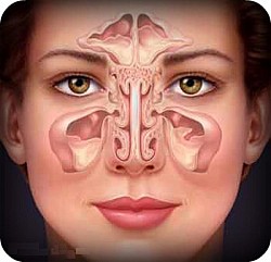 Компьютерная томография пазух носа